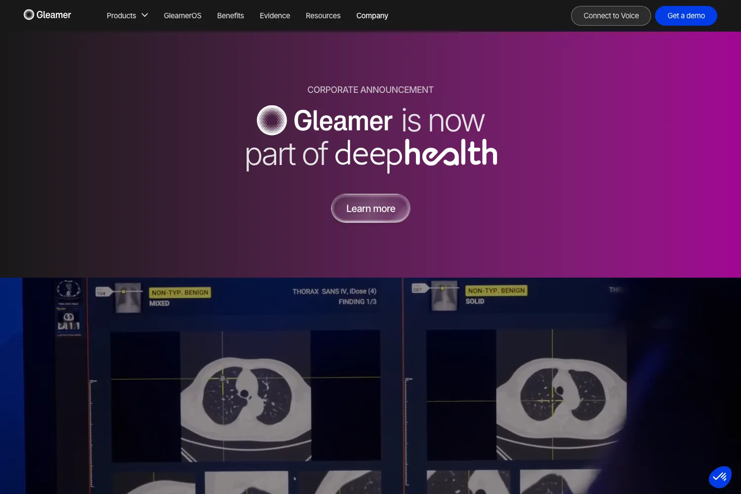 Gleamer